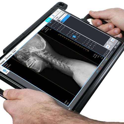 acuity_dr-portable-xray-ppc-hands