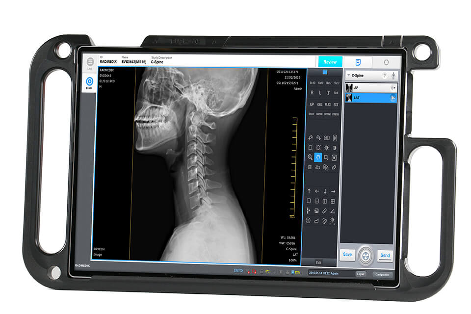 Xray windows