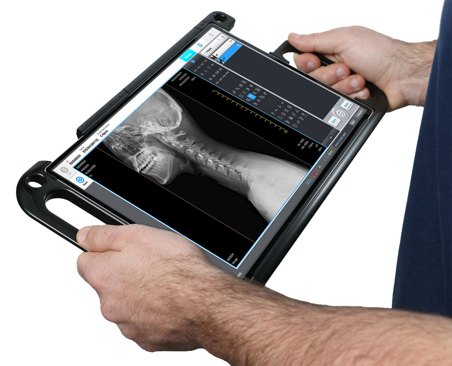 The Power of Multi Access point Digital Radiography