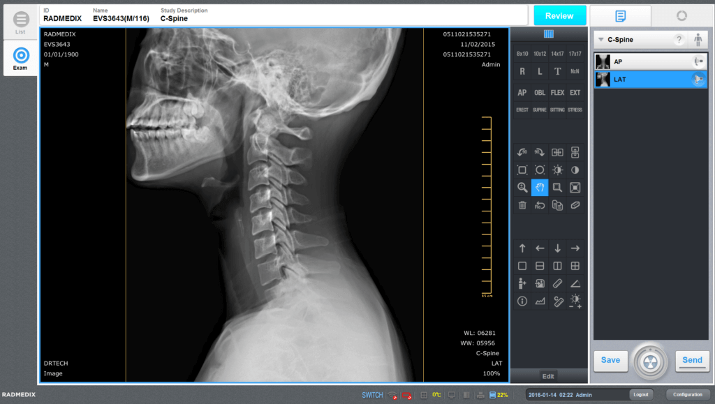 radmedix-accuvue_med-c-spine-lat