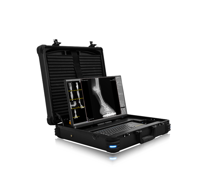 Acuity DR Go Equine Portable DR System