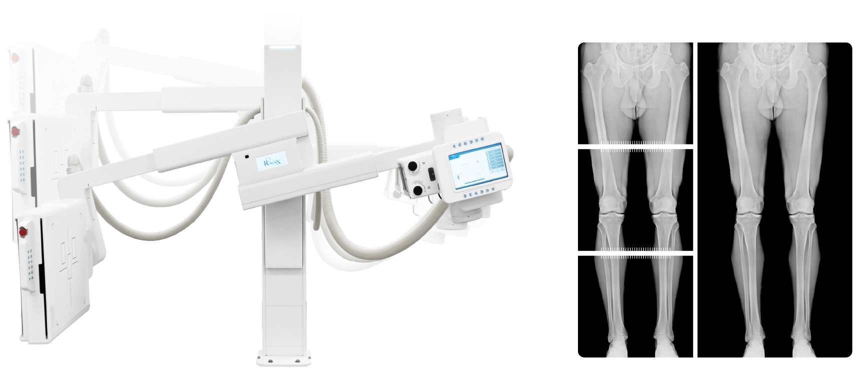 Acuity UDR Auto-Stitching