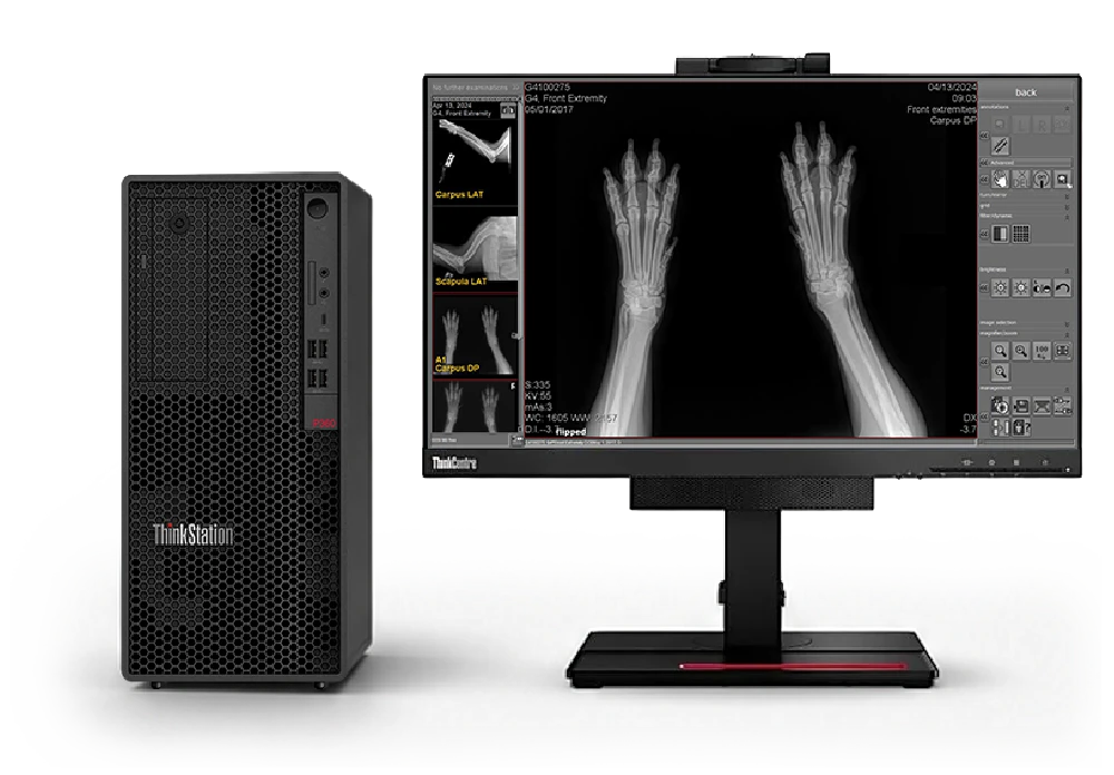 Acuity VDR-S X-Ray Machine - PC Workstation